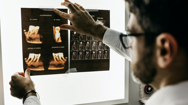 transformacao de radiografia em joias