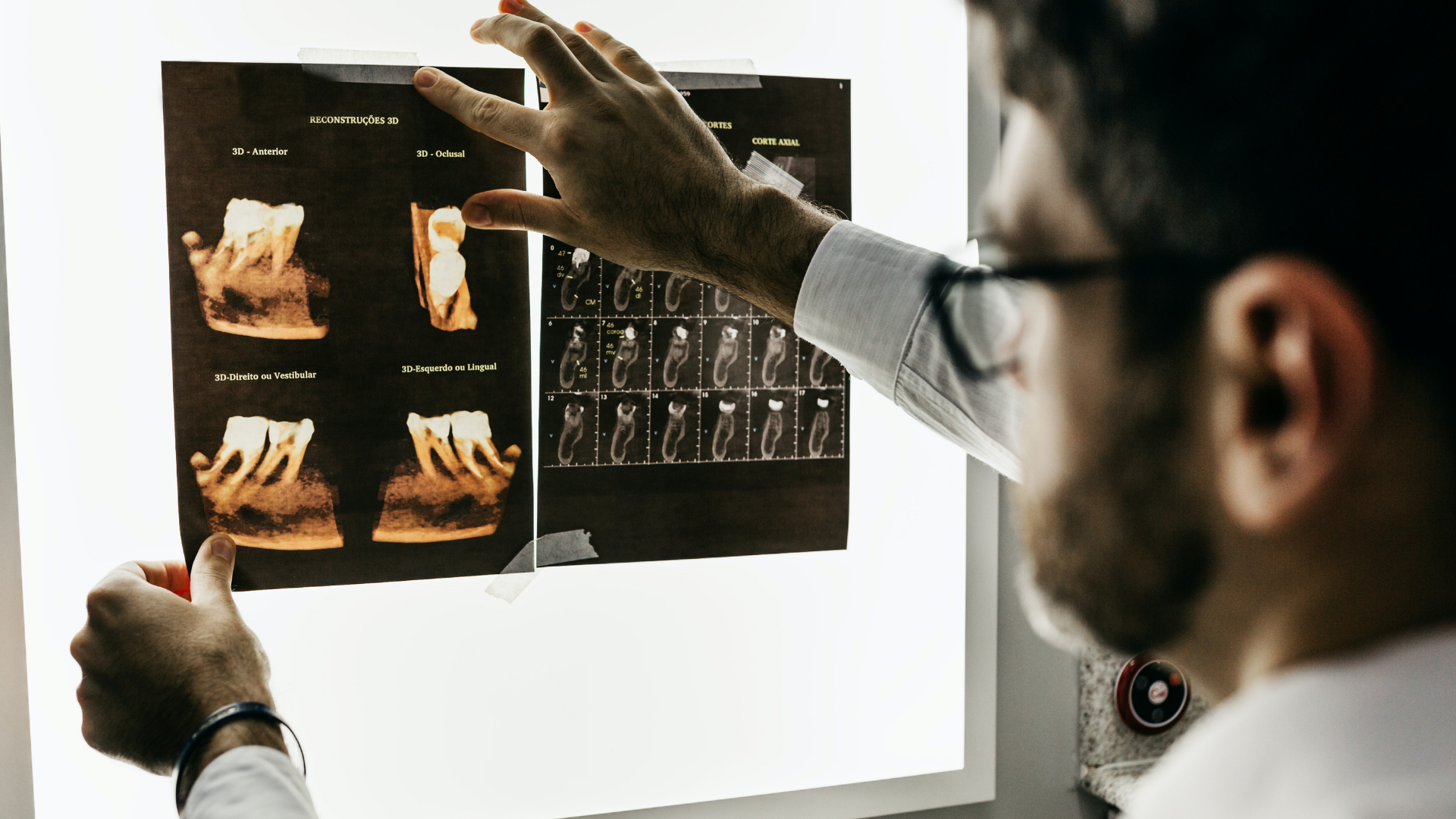 transformacao de radiografia em joias